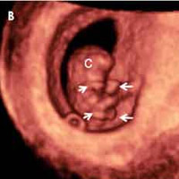 Imagenes de un bebe de 9 semanas